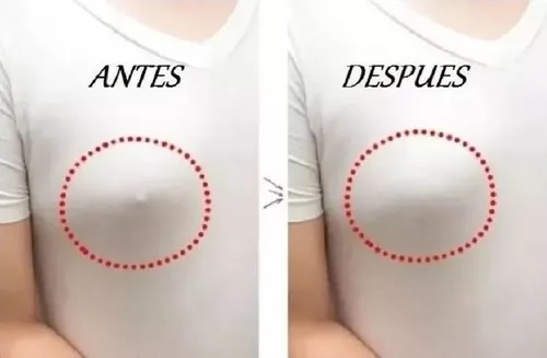 Pezoneras Realistas