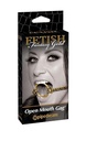 FFG Open Mouth Gag